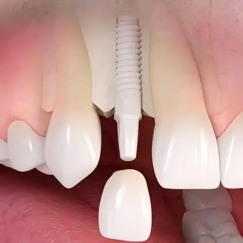 odontologia biológica Curitiba