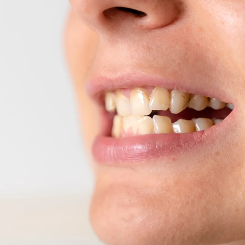 odontologia biológica Curitiba