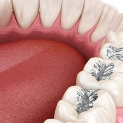 odontologia biológica Curitiba